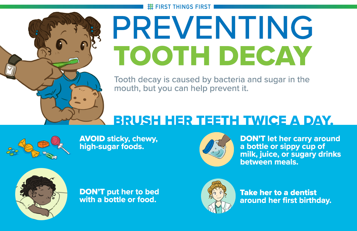 Prevent-Tooth-Decay